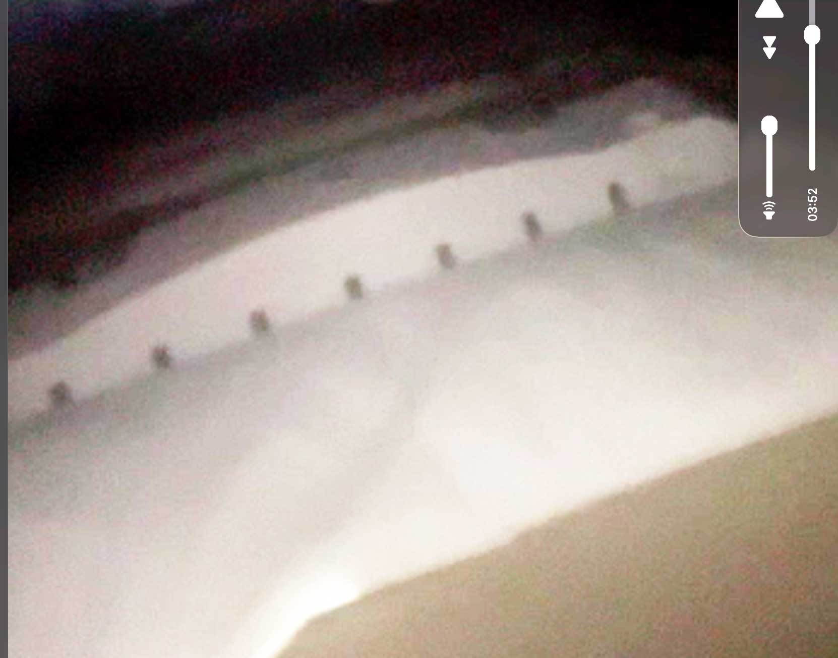 Dashboard cavity, undocumented enclosure